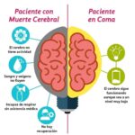 ¿Por qué el médico dice que es muerte cerebral? Signos y síntomas