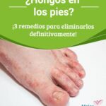 A qué médico acudir si se tienen hongos en los pies: tratamiento adecuado