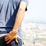 Me pica el ano, ¿a qué médico voy? Síntomas y tratamientos