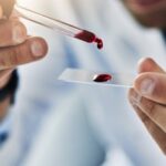 A qué se dedica un médico hematologo: especialidad y funciones