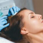 A qué médico debes visitar problemas de caída de pelo – Especialista en cabello