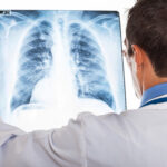 ¿Qué médico consultar para la tos crónica? – Guía y recomendaciones